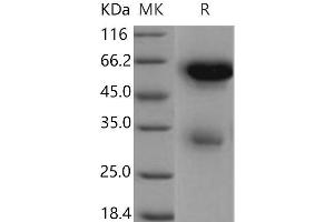 Western Blotting (WB) image for Legumain (LGMN) (Active) protein (His tag) (ABIN7196760) (LGMN Protein (His tag))