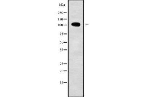 Western blot analysis of ADAM19 using HT29 whole cell lysates