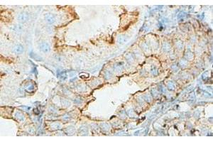 IHC analysis of formalin-fixed paraffin-embedded fetal kidney with cytoplasmic staining, using ACTBL2 antibody (1/100 dilution).