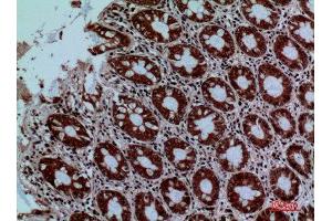 Immunohistochemistry (IHC) analysis of paraffin-embedded Human Colon, antibody was diluted at 1:100.