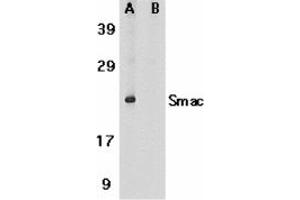Image no. 2 for anti-Second Mitochondria-Derived Activator of Caspase (DIABLO) (AA 225-239) antibody (ABIN204877) (DIABLO Antikörper  (AA 225-239))