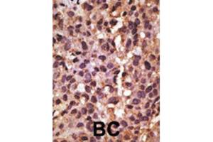 Immunohistochemistry (IHC) image for anti-BCL2/adenovirus E1B 19kDa Interacting Protein 3 (BNIP3) (BH3 Domain) antibody (ABIN2997216) (BNIP3 Antikörper  (BH3 Domain))