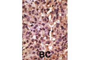 Immunohistochemistry (IHC) image for anti-BCL2/adenovirus E1B 19kDa Interacting Protein 3 (BNIP3) (BH3 Domain) antibody (ABIN2997216) (BNIP3 Antikörper  (BH3 Domain))