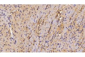 Detection of CAT in Mouse Cerebrum Tissue using Polyclonal Antibody to Catalase (CAT) (Catalase Antikörper  (AA 401-523))
