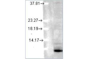 Western blot analysis of Ubiquitin in human cell lines using a 1/1000 dilution of AM12039PU (Clone 6C11-B3) (Ubiquitin Antikörper)