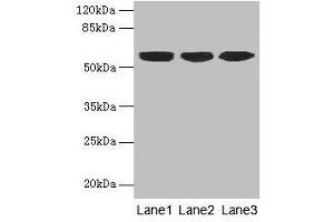 Western blot All lanes: KRT10 antibody at 6 μg/mL Lane 1: A431 whole cell lysate Lane 2: HepG2 whole cell lysate Lane 3: MCF-7 whole cell lysate Secondary Goat polyclonal to rabbit IgG at 1/10000 dilution Predicted band size: 59 kDa Observed band size: 59 kDa