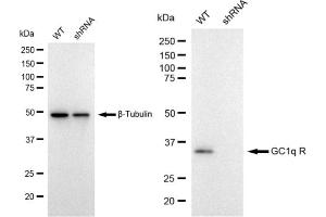 Western blotting analysis using GC1q R antibody (ABIN7798137). (Rekombinanter C1QBP Antikörper)