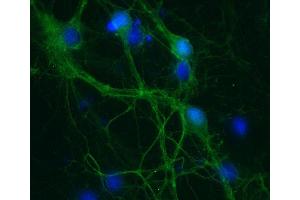 Indirect immunostaining of PFA fixed rat hippocampus neurons (dilution 1 : 500; green). (SNAP25 Antikörper  (AA 192-206))