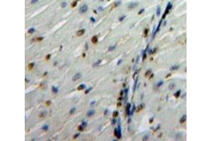 IHC-P analysis of Heart tissue, with DAB staining. (Glucocorticoid Receptor Antikörper  (AA 532-730))