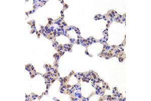 Immunohistochemistry of paraffin-embedded Mouse lung using NR5A2 antibody at dilution of 1:100 (x400 lens).