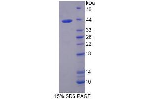 SDS-PAGE analysis of Mouse TIF1b Protein. (KAP1 Protein)