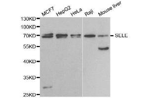 Western blot analysis of extracts of various cell lines, using SELE antibody. (Selectin E/CD62e Antikörper  (AA 22-230))