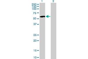 Western Blot analysis of IP6K1 expression in transfected 293T cell line by IP6K1 MaxPab polyclonal antibody. (IP6K1 Antikörper  (AA 1-441))