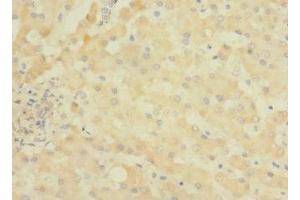 Immunohistochemistry of paraffin-embedded human liver tissue using ABIN7144737 at dilution of 1:100 (ASPHD1 Antikörper  (AA 96-390))