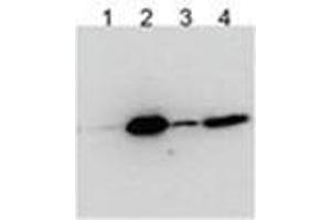 HEK293 overexpressing Human BICC1 with N-terminal FLAG, probed with Rabbit anti-BCC1 in Western Blot after IP using either AP31787PU-N or anti-FLAG antibody in the presence or absence of SDS. (BICC1 Antikörper  (Internal Region))