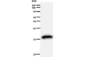 Western Blotting (WB) image for anti-Upstream Transcription Factor 2, C-Fos Interacting (USF2) antibody (ABIN930972)