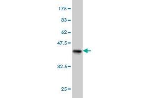 Western Blot detection against Immunogen (37. (PDHB Antikörper  (AA 250-359))