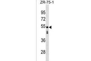 KT81L Antibody (N-term) (ABIN1539665 and ABIN2838076) western blot analysis in ZR-75-1 cell line lysates (35 μg/lane). (KT81L (AA 96-122), (N-Term) Antikörper)