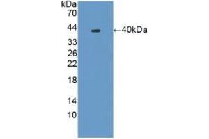 Detection of Recombinant PLA2R1, Mouse using Polyclonal Antibody to Phospholipase A2 Receptor 1 (PLA2R1)
