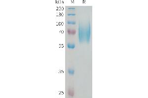 Human N Protein, His Tag on SDS-PAGE under reducing condition.