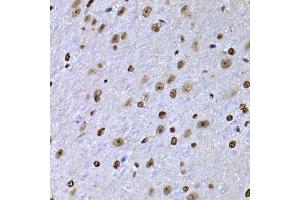 Immunohistochemistry of paraffin-embedded mouse brain using SOX5 antibody. (SOX5 Antikörper  (AA 1-120))