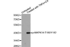 Western blot analysis of extracts from Hela cells using Phospho-MAPK14-T180/Y182 antibody. (MAPK14 Antikörper  (pThr180, pTyr182))