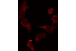 ABIN6275344 staining 293 by IF/ICC. (PECI/ECI2 Antikörper  (Internal Region))