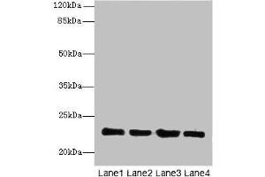 Western blot All lanes: HPCAL4 antibody at 2 μg/mL Lane 1: Mouse brain tissue Lane 2: Mouse kidney tissue Lane 3: Mouse ovarian tissue Lane 4: Human placenta tissue Secondary Goat polyclonal to rabbit IgG at 1/10000 dilution Predicted band size: 22 kDa Observed band size: 22 kDa (HPCAL4 Antikörper  (AA 2-191))