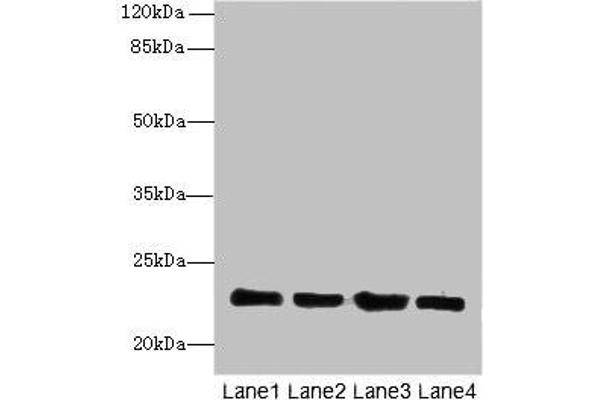 HPCAL4 anticorps  (AA 2-191)