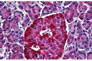 Human Pancreas, Islets of Langerhans: Formalin-Fixed, Paraffin-Embedded (FFPE) (STXBP1 Antikörper  (AA 74-169))