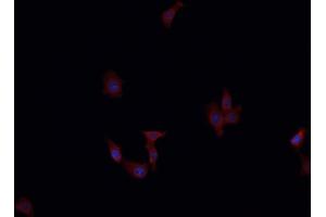 Immunofluorescence (fixed cells) (IF/ICC) image for anti-serpin Peptidase Inhibitor, Clade F (Alpha-2 Antiplasmin, Pigment Epithelium Derived Factor), Member 1 (SERPINF1) (C-Term) antibody (ABIN6265012)