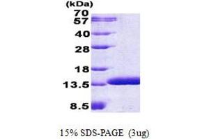 SDS-PAGE (SDS) image for Costars family protein ABRACL (ABRACL) (AA 1-81) protein (His tag) (ABIN5852979)
