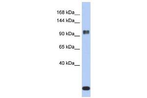 ATXN7 antibody used at 1. (ATXN7 Antikörper  (Middle Region))