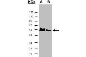 Western blot analysis of A: His-Hice1 (2x); B: His-Hice1 (1x) using a 7. (NYS48/HAUS8 Antikörper)