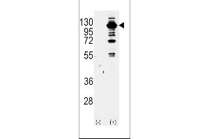 Western blot analysis of PI3KCG Antibody Pab using purified Pab using 293 cell lysates (2 ug/lane) either nontransfected (Lane 1) or transiently transfected with the PI3KCG gene (Lane 2). (PIK3 gamma Antikörper  (AA 518-547))