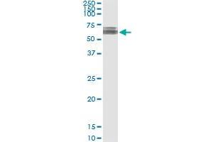 Immunoprecipitation of KLHDC4 transfected lysate using anti-KLHDC4 MaxPab rabbit polyclonal antibody and Protein A Magnetic Bead , and immunoblotted with KLHDC4 purified MaxPab mouse polyclonal antibody (B01P) . (KLHDC4 Antikörper  (AA 1-520))