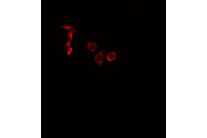 ABIN6266452 staining A549 cells by IF/ICC. (EPHA2/3/4 Antikörper  (pTyr588, pTyr596))