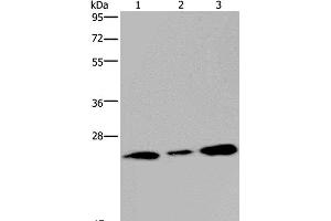 Western Blot analysis of Human fetal brain tissue and 293T cell using RAB3c Polyclonal Antibody at dilution of 1:400 (Rab3c Antikörper)