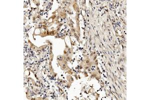 IHC analysis of MED4 using anti-MED4 antibody (ABIN7600817). (MED4 Antikörper  (AA 24-254))