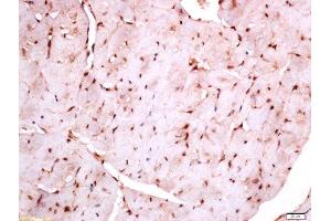 Paraformaldehyde-fixed, paraffin embedded rat heart, Antigen retrieval by boiling in sodium citrate buffer (pH6) for 15min, Block endogenous peroxidase by 3% hydrogen peroxide for 30 minutes, Blocking buffer (normal goat serum) at 37°C for 20min, Antibody incubation with Rabbit Anti-APOC3 Polyclonal Antibody, Unconjugated  at 1:200 overnight at 4°C, followed by a conjugated secondary for 90 minutes and DAB staining. (APOC3 Antikörper  (AA 41-80))