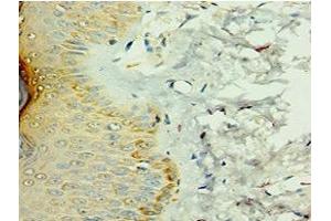 Immunohistochemistry of paraffin-embedded human skin tissue using ABIN7156908 at dilution of 1:100