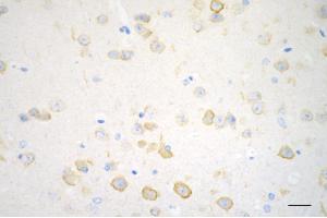 anti-Prolyl Endopeptidase Like Protein (PREPL) antibody