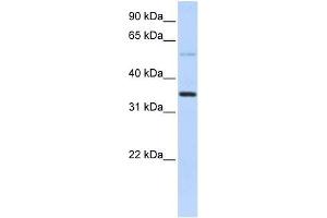 Transfected 293T; WB Suggested Anti-ANKRD9 Antibody Titration: 0. (ANKRD9 Antikörper  (Middle Region))