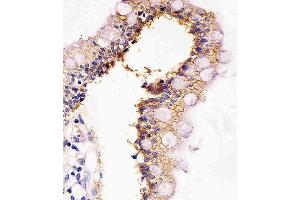 Paraformaldehyde-fixed, paraffin embedded human colon tissue, Antigen retrieval by boiling in sodium citrate buffer (pH6. (E-cadherin Antikörper)