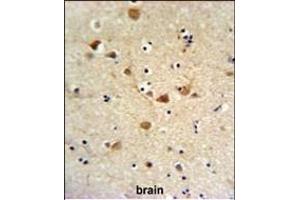 Immunohistochemistry (Paraffin-embedded Sections) (IHC (p)) image for anti-Fc Fragment of IgG, High Affinity Ia, Receptor (CD64) (FCGR1A) (AA 217-245) antibody (ABIN651123)