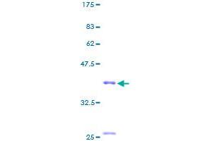 MIA Protein (AA 1-131) (GST tag)