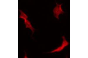 ABIN6267536 staining MDA-MB-435 by IF/ICC. (MAP2K3 Antikörper  (pSer189))