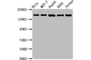 Western Blot Positive WB detected in: Hela whole cell lysate, MCF-7 whole cell lysate, HepG2 whole cell lysate, K562 whole cell lysate, Jurkat whole cell lysate All lanes: HDAC6 antibody at 1. (Rekombinanter HDAC6 Antikörper)
