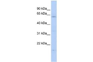 Western Blotting (WB) image for anti-F-Box and WD Repeat Domain Containing 11 (FBXW11) antibody (ABIN2458711) (FBXW11 Antikörper)