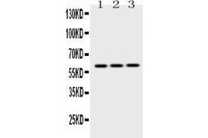 Western blot analysis of EPHX2 expression in rat lung extract ( Lane 1), mouse lung extract ( Lane 2) and HEPG2 whole cell lysates ( Lane 3). (EPHX2 Antikörper  (C-Term))